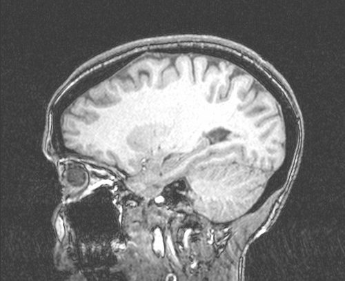 Sentencing Offenders Suffering from a Mental Disorder