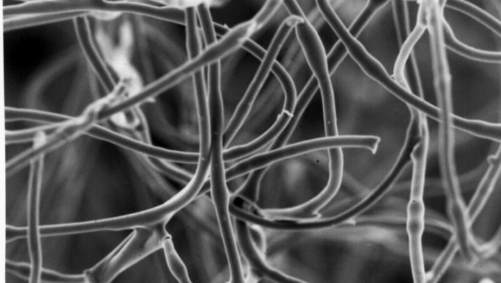 Transfer of Fibres – Major New Research Published